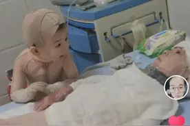 饭店起火一家四口重度烧伤 兄妹携手疗伤共渡难关感动网友图片