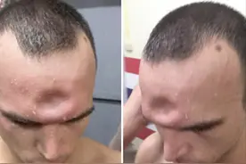 你这一胳膊肘下去，对方的头骨都可能会被干裂？硬核分析不容错过图片