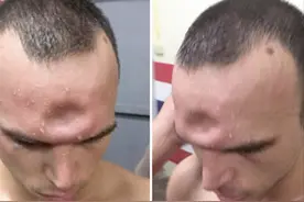 你这一胳膊肘下去，对方的头骨都可能会被干裂？硬核分析不容错过图片