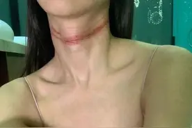 深夜用电线缠颈欲自杀！香港人气女星不堪网络暴力，情绪彻底崩溃图片