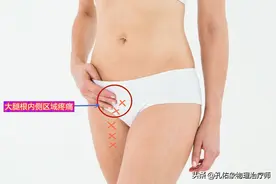 为什么很多女性大腿根内侧疼痛，医生详细告诉您具体原因，请收藏图片