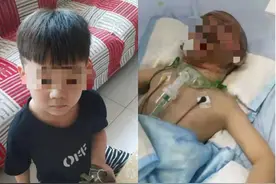 “保定7岁男童为救太奶奶被烧伤”追踪：将进行第二次手术，还有一个好消息图片