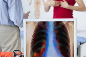 医疗纠纷：患者胸壁结核病灶清除不彻底病情复发医方承担责任图片