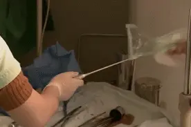 比分娩还要痛的手剥胎盘，到底有多痛？几张图带你了解图片