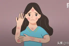 7种皮肤病又红又痒，积水潭医生教你对图自查(附治疗方法)图片