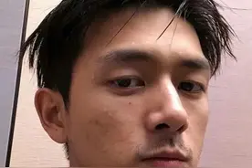 妆前妆后差距大！15位男星素颜曝光，皮肤坑坑洼洼，残留动脸痕迹图片