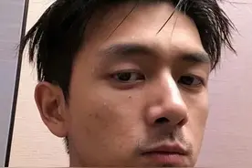 妆前妆后差距大！15位男星素颜曝光，皮肤坑坑洼洼，残留动脸痕迹图片
