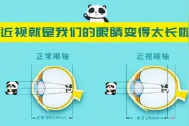 高度近视最该查什么？这份检查单项目超全图片