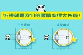 高度近视最该查什么？这份检查单项目超全图片