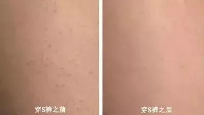 这条打底裤堪称裤子界小米，燃脂提臀还滋润身体，重点是自带磁疗