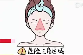19岁女孩挤痘痘引发“颅内感染”，网友：要不…把我手剁了？图片
