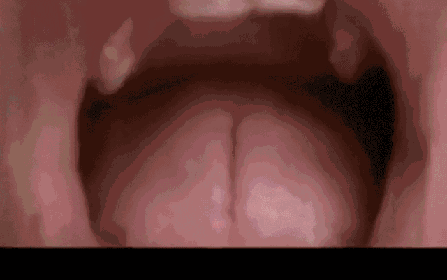 涓€娆惧彿绉?鈥滀笂甯濆垱閫犵殑鐗欒啅鈥?姊呭ゥ鍖婚櫌閮芥槸鎸囧畾瀹?缃戝弸锛氫竾鑳? onerror=