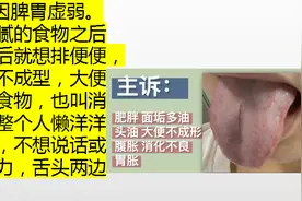经常拉肚子、腹泻是怎么回事？有哪些中成药可以参考？图片