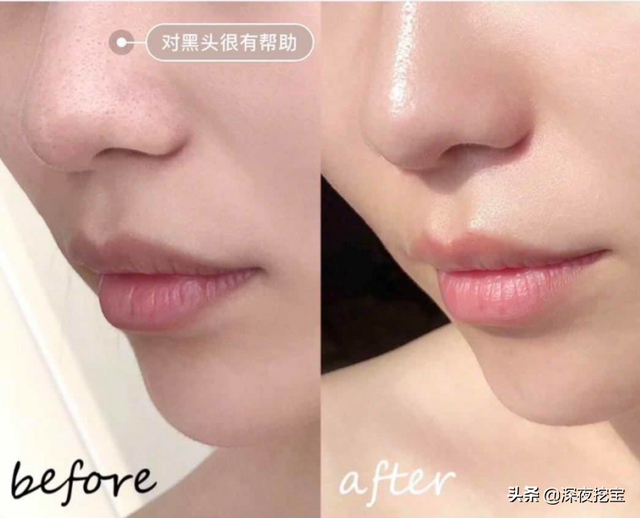 小心！这8个护肤品红黑榜，再便宜也别瞎买