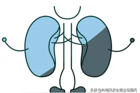 肌酐偏高，与痛风有什么关系？如何降低肌酐？一文讲清图片