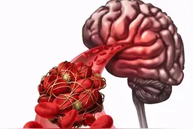 脑梗患者，家庭康复有妙招，坚持5个“不”，敢于正视才能更健康图片