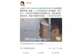 知名艺人眼睛睑板腺消失，医生：不可能彻底恢复图片