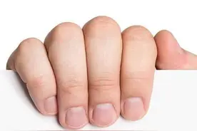 为什么有的人指甲上有月牙，有的人却没有？这才是科学的解释图片