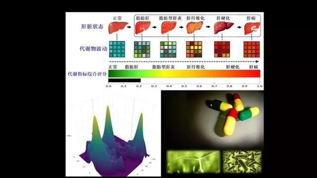 贾伟：肝病肠治？且看肠道细菌如何对肝病推波助澜