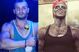 法国男子梦想成为外星人 欲截掉4根手指 已成功改造鼻子耳朵上唇图片