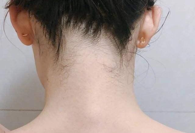 鑴栧瓙鍜岃劯鑹插樊澶ぇ锛屼笂濡嗛兘琛ユ晳涓嶄簡锛熼閮ㄦ姉榛戞姉鐨卞疄鐢ㄦ寚鍗? onerror=