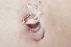 被甲鱼咬到会令人崩溃图片