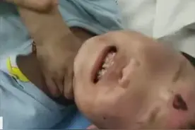 “后妈”狠毒，亲爸也动手打？4岁女童疑遭虐待进ICU，生母发声：将争取抚养权图片