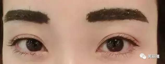 洗眉痛吗 洗眉痛不痛(图1) 洗眉痛吗 洗眉痛不痛(图1)