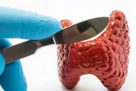 今天就主要讲讲促甲状腺激素偏高的原因和危害图片