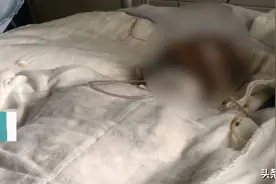 男子泼汽油烧伤同居女友，现场惨烈“一扶肉就掉”！扬言：字典里只有丧偶图片