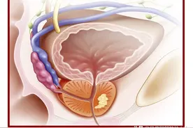 术前良性病，术后恶性肿瘤，究竟谁之过？图片
