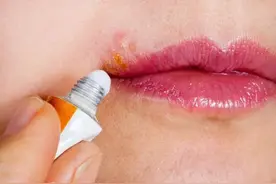 嘴边长痘痘怎么消除的妙招图片