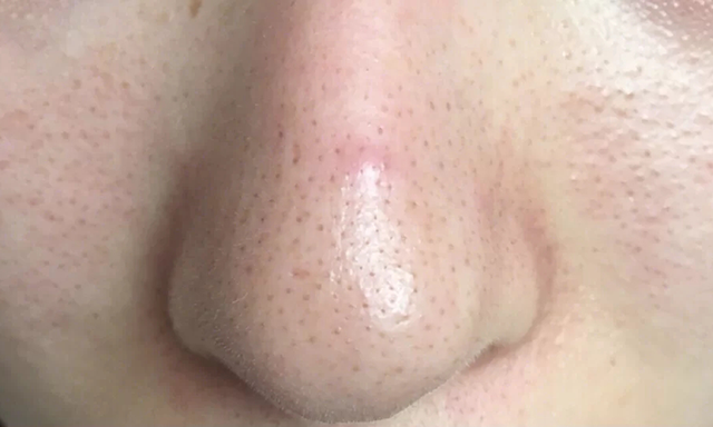 在护肤过程中,我们不应该忽视面部毛孔的问题.