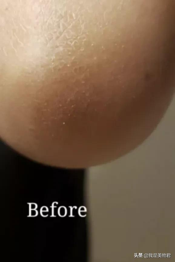 强生润肤乳过期了能涂身体吗