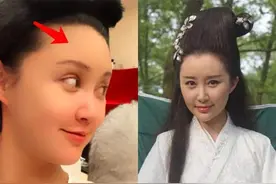 自体脂肪填充是永久的吗？对比舒畅奚梦瑶填充效果就知道了图片