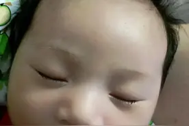 坑娃的“睡扁头”危害大！如何纠正？图片
