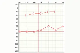 助听器分气导和骨导？价格、效果区别在哪？国家高级听力师帮你选图片