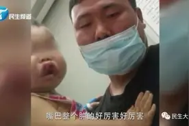 1岁孩子嘴唇上翻，两天后被确诊白血病！孩子妈妈痛哭：当时还以为是上火了图片