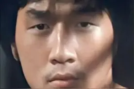 割双眼皮影响有多大？他们都是血淋淋的例子图片