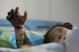 四川的蛇不怕人吗？宜宾、泸州毒蛇活动频繁 多人被蛇咬伤：要小心图片