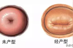 婚前做过人流手术，要不要跟医生坦白？图片