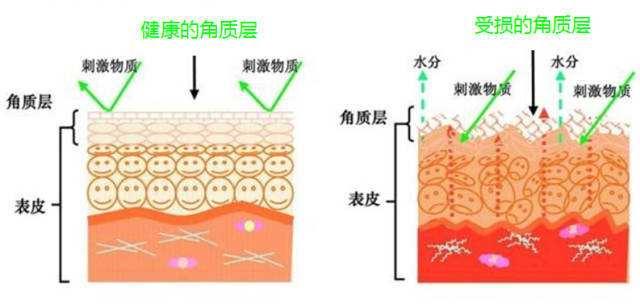 女生身上鸡皮肤好吗