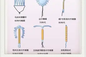 节育环一直不取出来，会长到肉里吗？劝告：再怕疼也要按时取出图片
