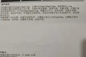 甲状腺全切后有了很多后遗症，我自己亲身经历图片