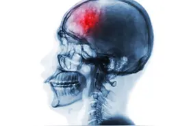 脑血管疾病常用中成药图片