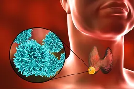 若是患上甲状腺癌，患者还能活多长时间？不妨了解一下图片