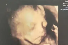 辰辰成长日记——四维图片