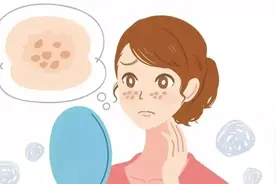 祛斑掉痂后，生长因子、维生素E乳如何使用？图片