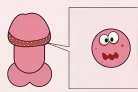 丁丁上怎么长了“小疙瘩、小红点”？难道是染上了性病？图片