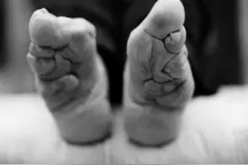 中国历史上“三寸金莲”这一陋习有多残忍？它起源于哪个朝代？图片